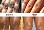 Skin Lightening| Brightening| Bleaching+27 81 850 2816