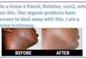 Permanent Skin Lightening Cream+27 81 850 2816