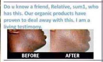 Permanent Skin Lightening Cream+27 81 850 2816