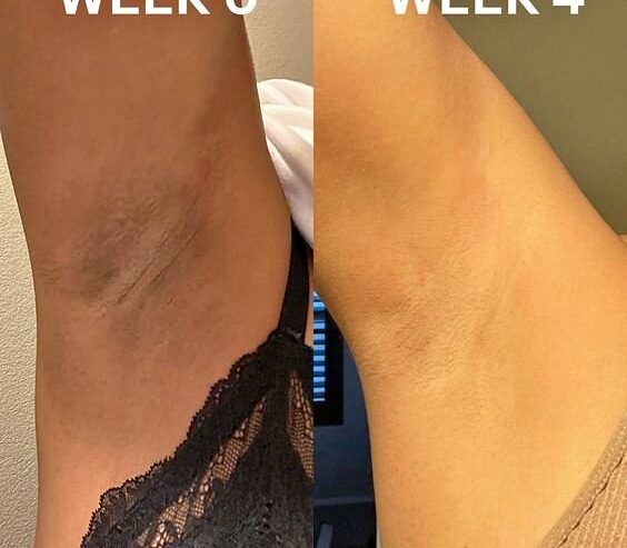 Permanent Skin Lightening Cream+27 81 850 2816