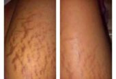 Permanent Skin Lightening Cream+27 81 850 2816