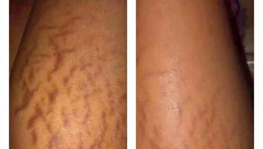 Permanent Skin Lightening Cream+27 81 850 2816