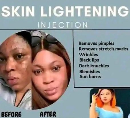 Skin lightening cream and pills+27 81 850 2816