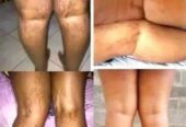 Skin lightening cream and pills+27 81 850 2816