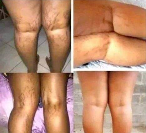Skin lightening cream and pills+27 81 850 2816