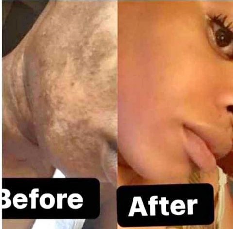 SKIN LIGHTENING/SKIN WHITENING PRODUCTS+27 81 850 2816