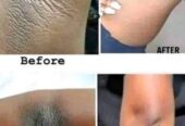 SKIN LIGHTENING/SKIN WHITENING PRODUCTS+27 81 850 2816