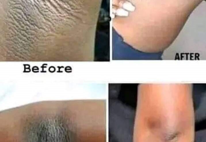 SKIN LIGHTENING/SKIN WHITENING PRODUCTS+27 81 850 2816