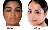 SKIN WHITENING AND SKIN BLEACHING CREAM+27 81 850 2816
