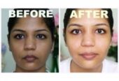 Skin Whitening Injections/pills+27 81 850 2816